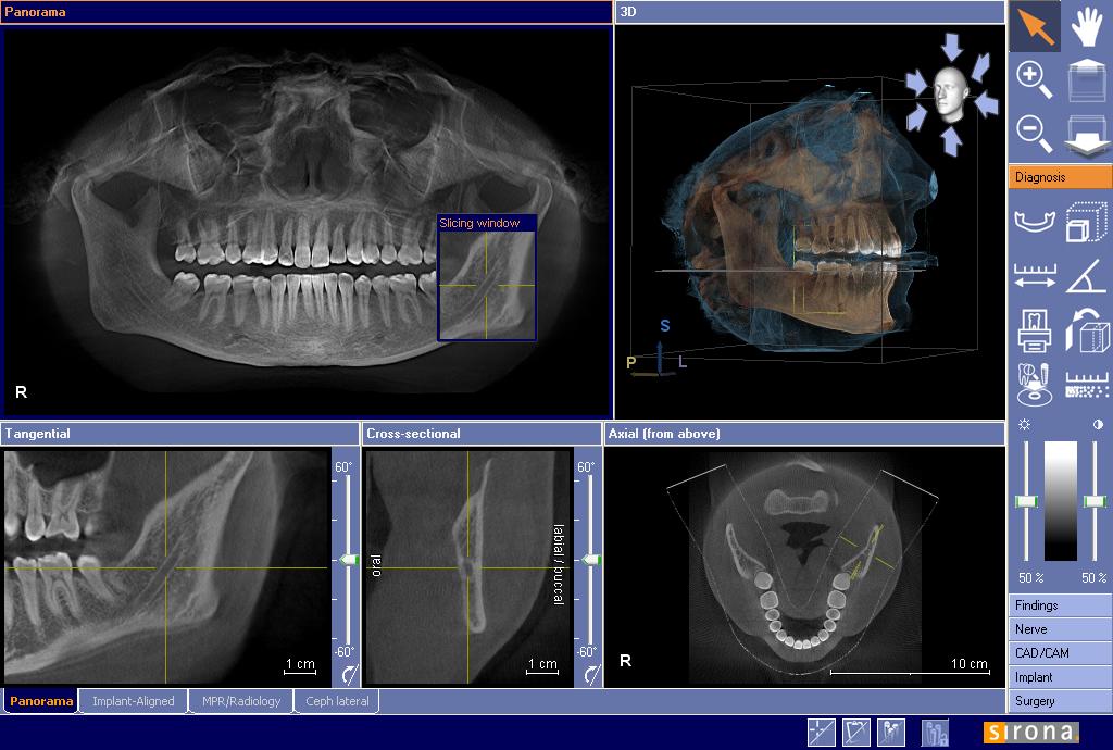 3D Cone Beam Technology