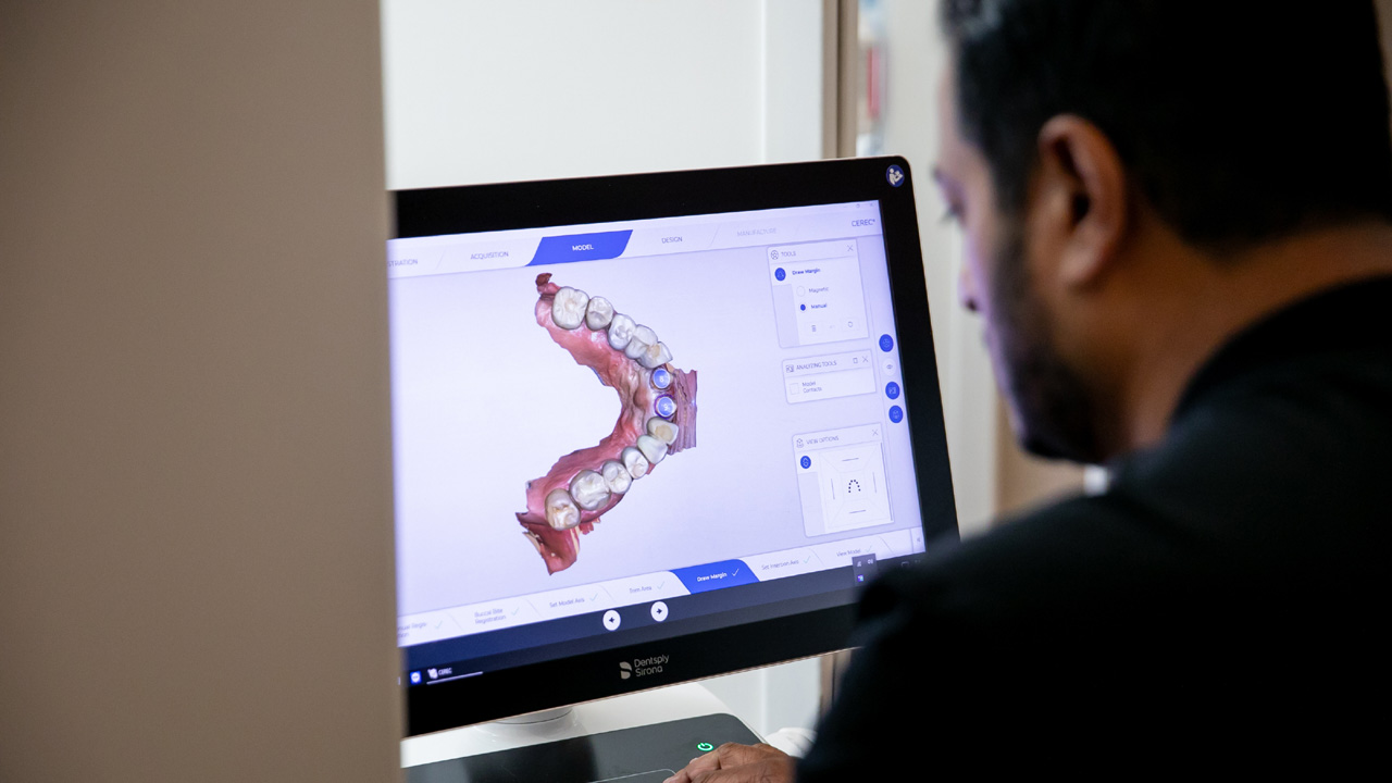 How to Choose the Right Cosmetic Dentist for Your Smile Makeover